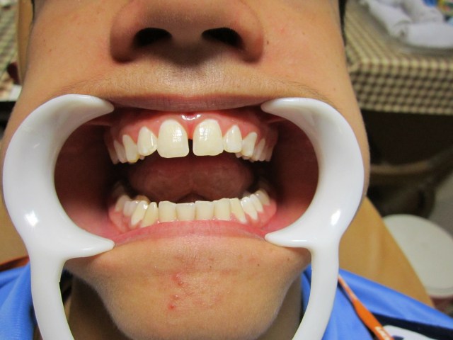 Control Marzo 2013-1