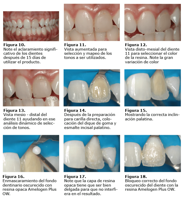 Caso en imágenes-02