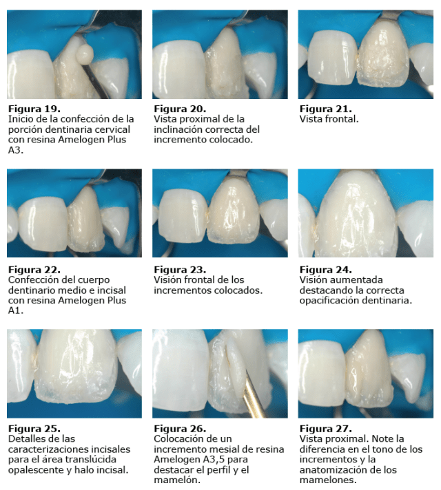 Caso en imágenes-03