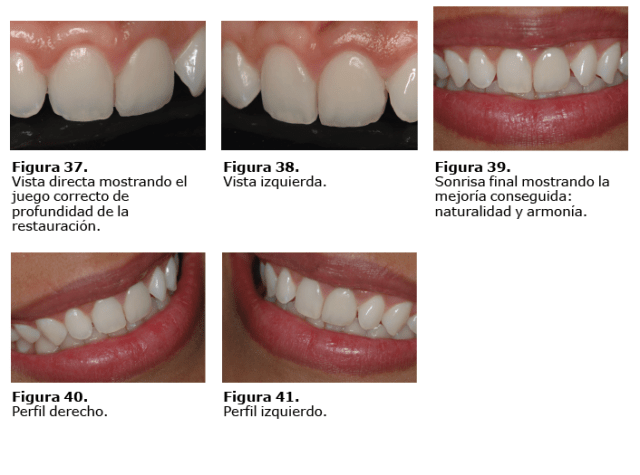 Caso en imágenes-05