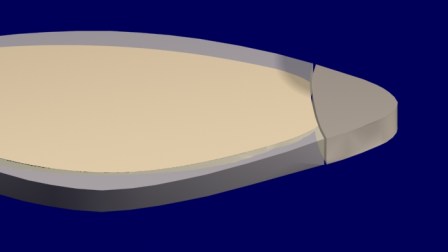 Al colocar la resina compuesta directa (y no antes!!!) aparece la sombra en el esmalte vestibular (el Halo Oscuro).