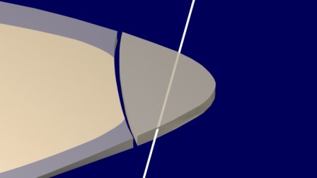 Rayos de luz se pierden hacia Palatino, a través de la Resina Compuesta (como es natural) Se ve una separación entre la Resina compuesta y la estructura dentaria: corresponde al adhesivo.