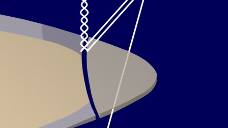 Un segundo rayo, paralelo al anterior, refleja en la superficie externa del esmalte, interfiriéndose con el anterior. Se crea la causa y se instala el Halo (zona sombreada sobre el esmalte vestibular).