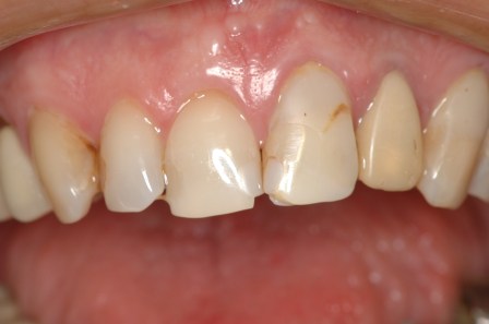 Figura 29: Caso inicial.