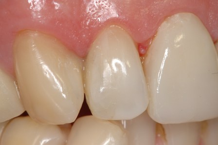 Figura 55: Caso final.