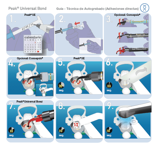 Self Etch Technique Guide - Traducida-01