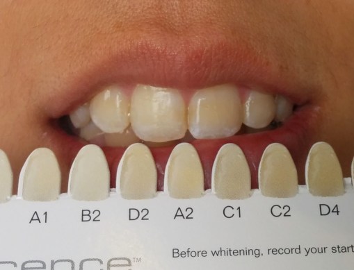 Registro inicial del color. 