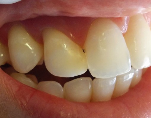 Pieza 1.2 (1.3). Imagen inicial.