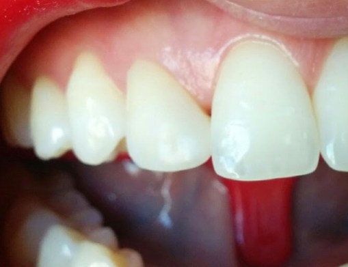 Restauración finalizada.