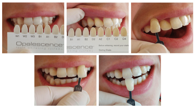 Registro del color inicial. 