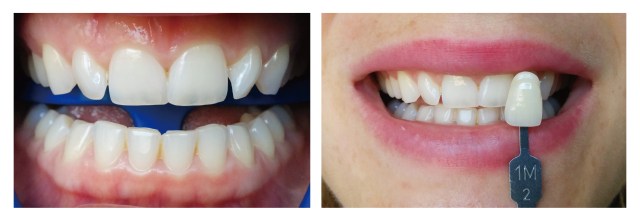 Registro del color inicial. 