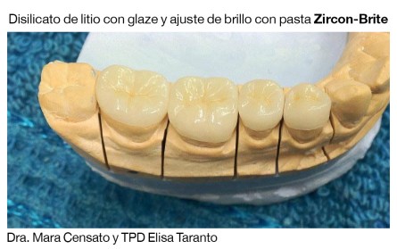 mara-censato-disilicato-de-litio