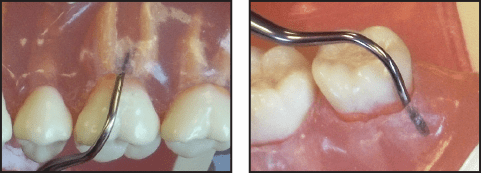 reina-de-corazones_2-jpg