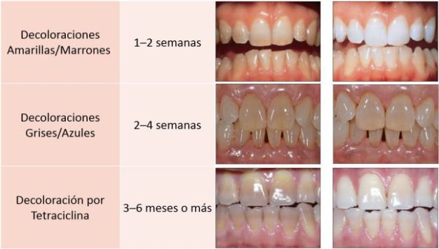 tipos de decoloraciones