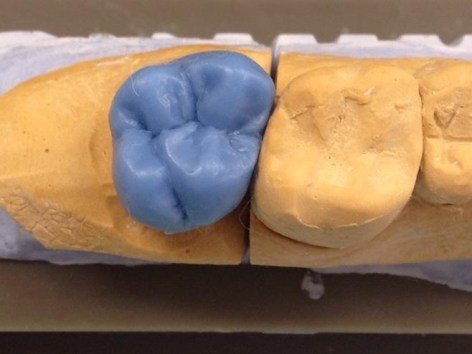 Encerado Elisa Taranto